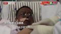 两名感染中共病毒的武汉医师虽然逃过死劫，却全身暗沉整脸发黑。（视频截图）
