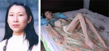 赵烨被迫害前后。
