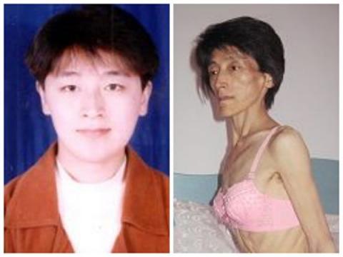 20年迫害 中共对法轮功学员的血腥摧残