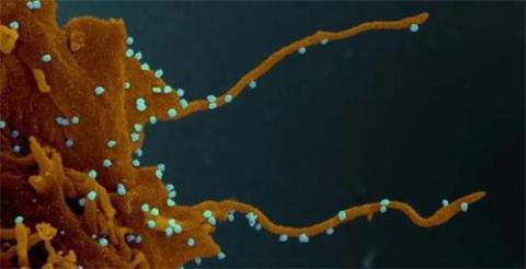 图2：细胞被武汉肺炎（新冠病毒）感染后形成大量释放病毒的伪足（示意图，白色颗粒示病毒颗粒，图片自Elizabeth Fischer， Microscopy Unit NIH/NIAID.）